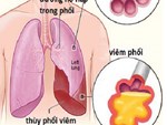 5 thực phẩm được ví là máy hút bụi cho phổi: Thường xuyên ăn, phổi sẽ được dọn sạch sẽ-7