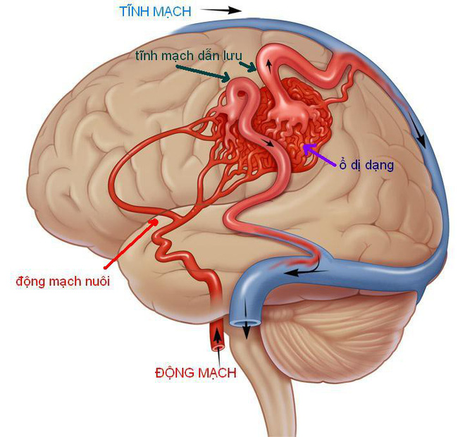 Đang cho con ăn, bà mẹ bất ngờ đột tử: Thủ phạm là căn bệnh cực nguy hiểm-2