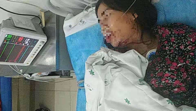 Sự thật về cô dâu Vĩnh Long nghi bị chồng Trung Quốc đánh đập chảy máu, nhập viện cấp cứu-1