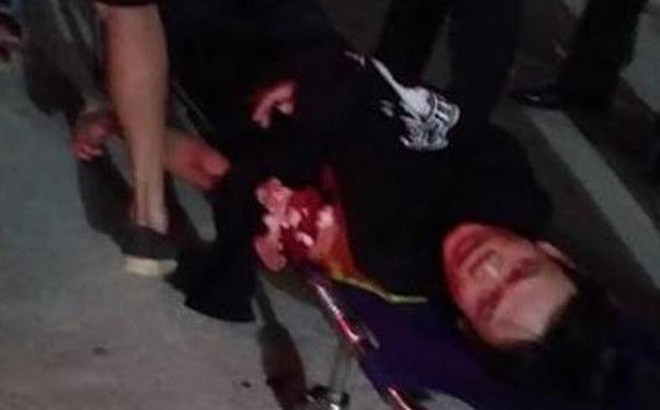 Chém nhau kinh hoàng​ trong bữa tiệc sinh nhật, 4 người bị thương nặng-1