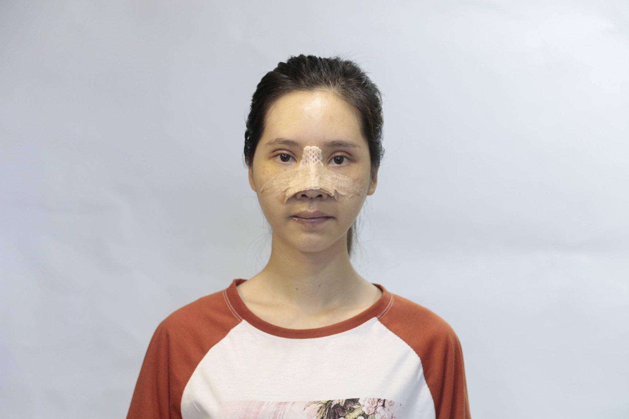 Mặt xấu xí như vậy chỉ đem lại vận xui - lời từ chối khi xin việc và màn lột xác ngoạn mục của cô gái trẻ khiến bao người ngỡ ngàng-4