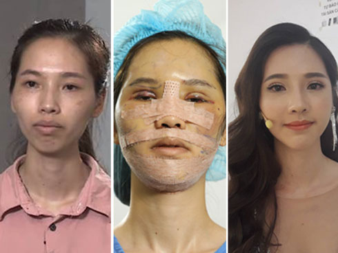 Đọ ảnh sau 4 năm, cô gái tặng dân mạng 1 phen bất ngờ vì bộ mặt gấu trúc hóa kiêu sa-5