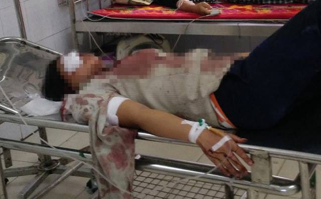 Chồng chém vợ nguy kịch sau khi được xã mời lên hòa giải ly hôn-1