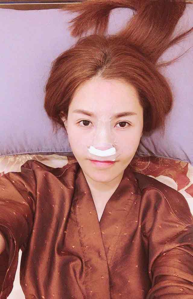 Khi sao Việt dùng dao kéo” để cải thiện nhan sắc: người lên hương, kẻ chật vật tới 6 lần-13