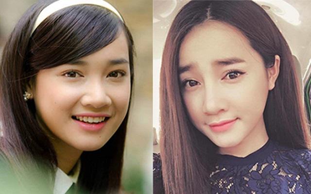 Khi sao Việt dùng dao kéo” để cải thiện nhan sắc: người lên hương, kẻ chật vật tới 6 lần-6