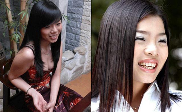 Khi sao Việt dùng dao kéo” để cải thiện nhan sắc: người lên hương, kẻ chật vật tới 6 lần-8