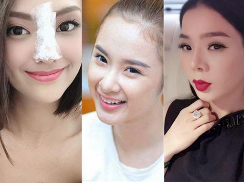 Khi sao Việt dùng “dao kéo” để cải thiện nhan sắc: người lên hương, kẻ chật vật tới 6 lần