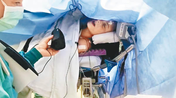 Vừa mổ não vừa hát vang, cô gái 19 tuổi khiến hàng triệu người thán phục-2