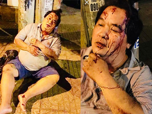 Hoàng Mập kể tai nạn kinh hoàng suýt về chầu ông bà-5