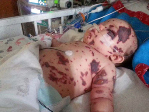 Căn bệnh nhầm tưởng sốt virus giết chết 3 người ở Hà Tĩnh thực chất là bệnh gì?-2