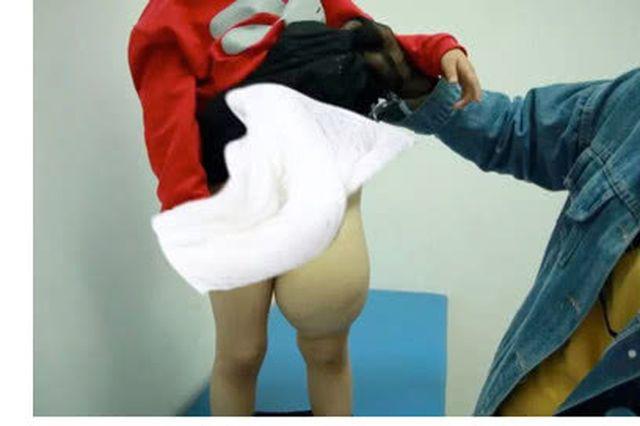 Bé gái 4 năm không mặc quần khiến bác sĩ kinh ngạc khi vừa vén váy lên-1