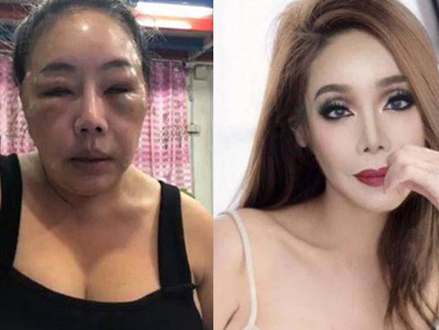 Cuộc đời của nữ đại gia 5 đời chồng: Bị phi công bạo hành vẫn đòi tuyển chồng sạch sẽ-11