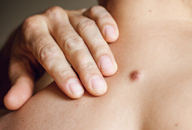 Nếu bỗng nhiên thấy sưng hoặc nổi cục ở cổ và tai, đừng bao giờ bỏ qua những khả năng này-3