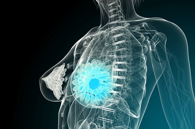 Ung thư cũng biết chọn mặt gửi mầm bệnh với 8 nhóm người: Ai cũng nên xem để phòng tránh-2