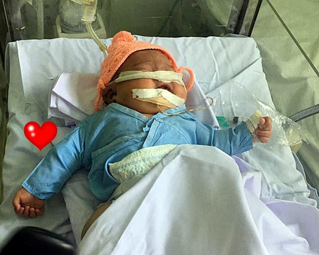 Bé gái sơ sinh 4kg bị gãy tay, nguy kịch vì bác sĩ đỡ đẻ sai cách-2