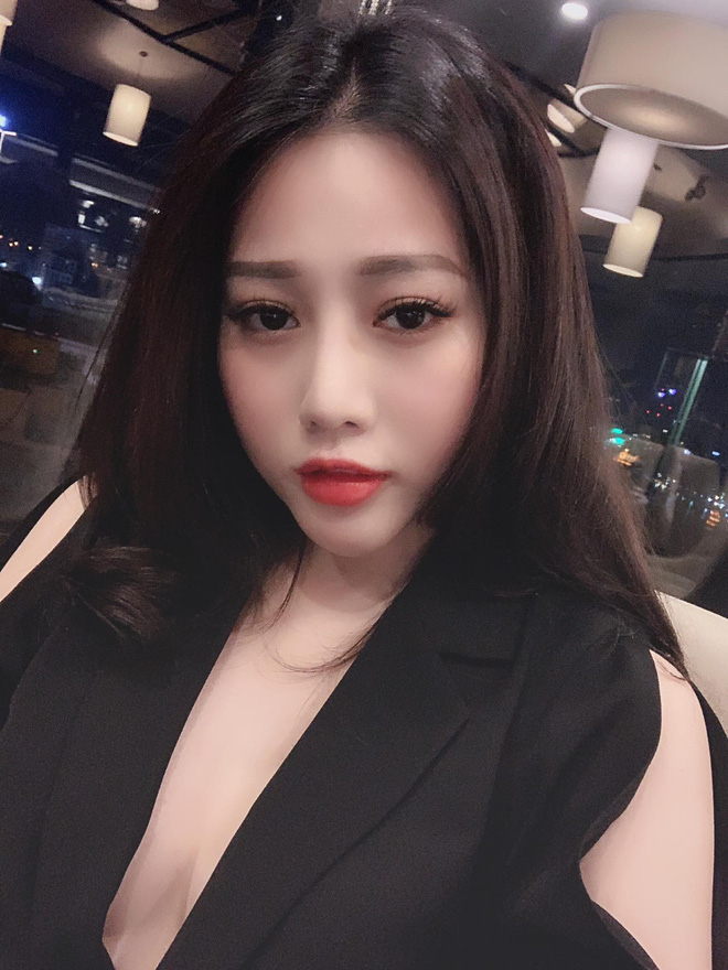 Cô gái trẻ phải tháo độn cằm vì biến chứng do tiêm chất làm đầy từ 4 năm trước-6