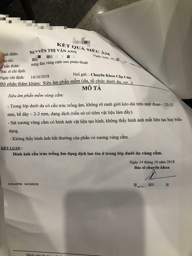Cô gái trẻ phải tháo độn cằm vì biến chứng do tiêm chất làm đầy từ 4 năm trước-3