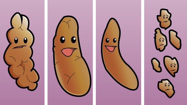 Có thể bạn đã mắc bệnh ung thư trực tràng nếu gặp phải một trong 5 triệu chứng bất thường sau-2