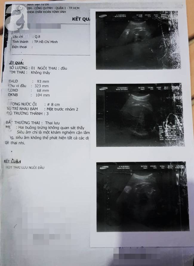 Bệnh viện Từ Dũ công bố nguyên nhân vụ thai phụ 24 tuổi bị mất con sắp sinh: Do đột tử-5