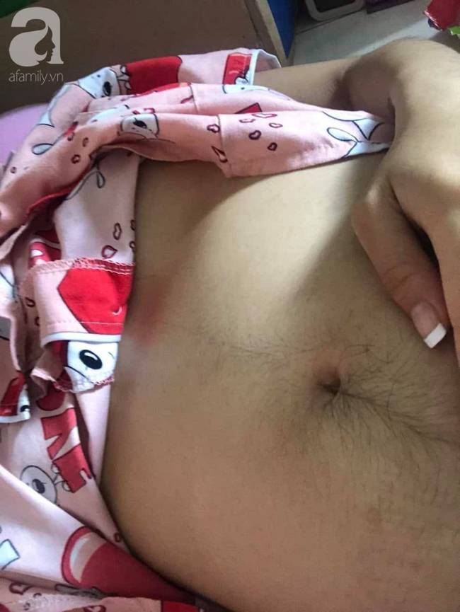 Bệnh viện Từ Dũ công bố nguyên nhân vụ thai phụ 24 tuổi bị mất con sắp sinh: Do đột tử-6