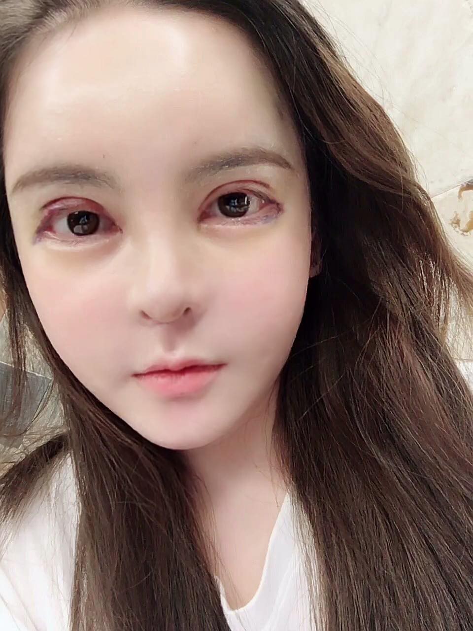 Sau 4 năm chi hàng tỷ đồng đập mặt xây lại, hot girl dao kéo Vân Tokyo gây tranh cãi vì cứ đẻ xong lại PTTM-13