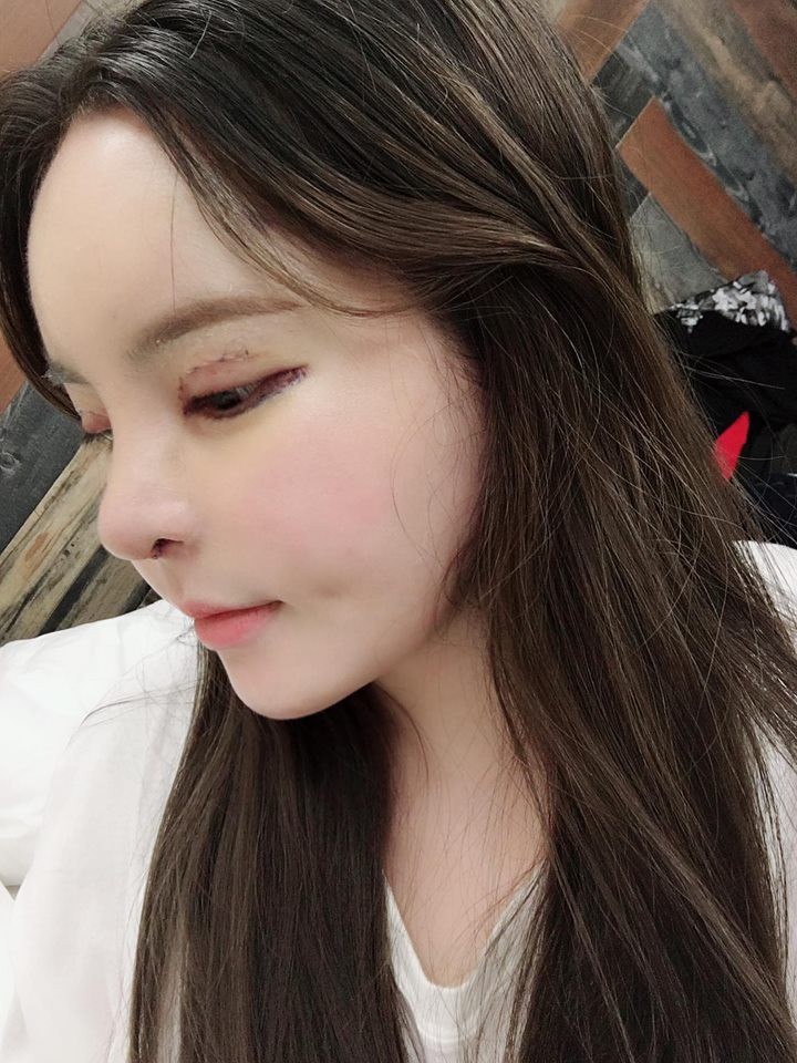 Sau 4 năm chi hàng tỷ đồng đập mặt xây lại, hot girl dao kéo Vân Tokyo gây tranh cãi vì cứ đẻ xong lại PTTM-11