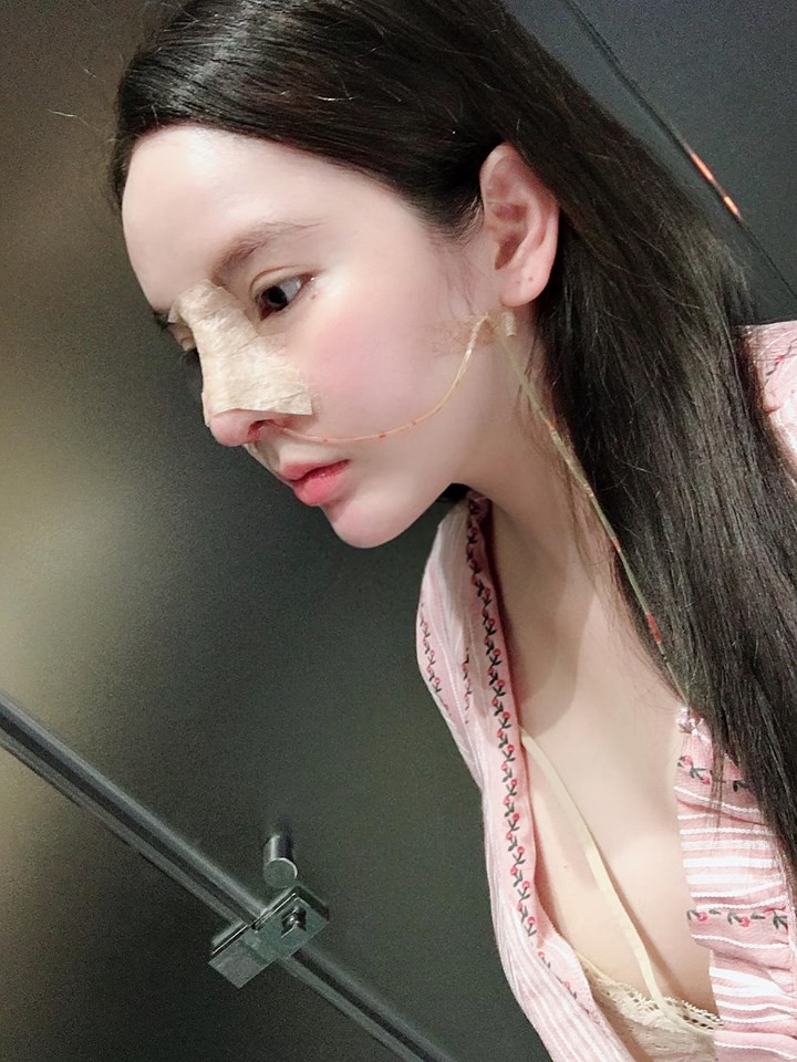 Sau 4 năm chi hàng tỷ đồng đập mặt xây lại, hot girl dao kéo Vân Tokyo gây tranh cãi vì cứ đẻ xong lại PTTM-12