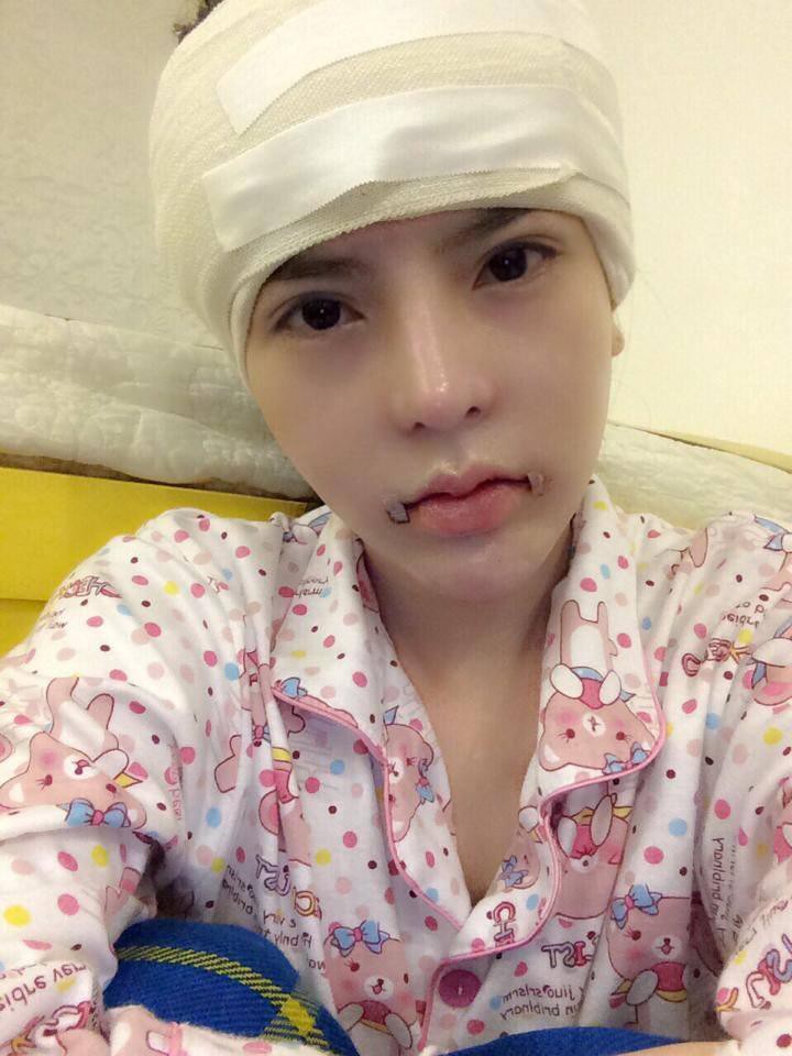 Sau 4 năm chi hàng tỷ đồng đập mặt xây lại, hot girl dao kéo Vân Tokyo gây tranh cãi vì cứ đẻ xong lại PTTM-3