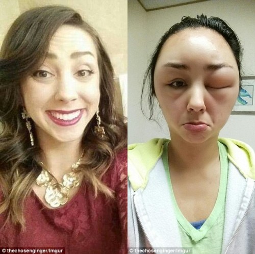 Có chị em biến dạng đầu, xơ gan chỉ vì nhuộm tóc, chuyên gia đưa ra nguyên tắc sống còn để tránh gặp họa-3