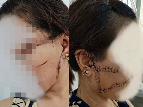 Hé lộ lý do người đàn ông tử vong lõa thể trong căn nhà 3 tầng-2