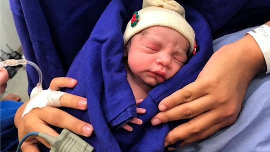 Cận cảnh em bé đầu tiên ra đời từ tử cung người đã chết-1