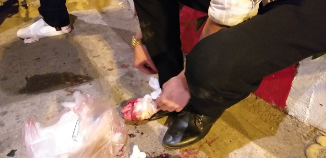 Tai nạn giao thông liên tiếp trong lúc CĐV xuống đường ăn mừng chiến thắng Việt Nam - Philippines-5