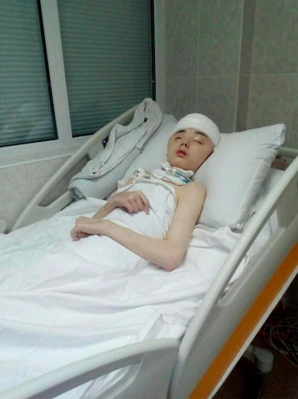 Chống trả tên hàng xóm cưỡng hiếp mẹ, cậu học sinh bị đánh mất nửa hộp sọ, mẹ đau đớn không dám đến thăm con-8