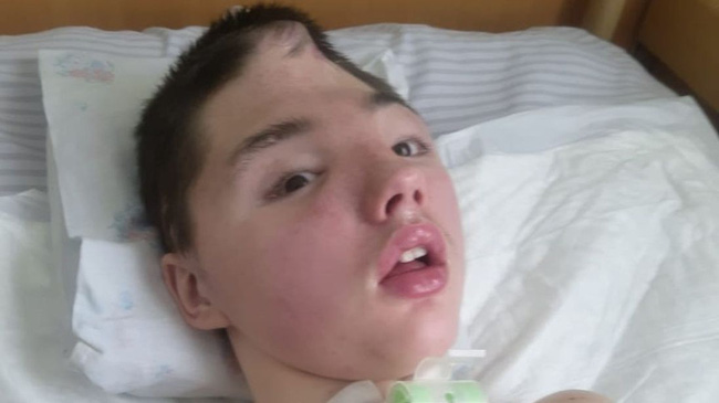 Chống trả tên hàng xóm cưỡng hiếp mẹ, cậu học sinh bị đánh mất nửa hộp sọ, mẹ đau đớn không dám đến thăm con-6