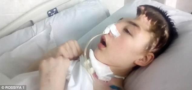 Chống trả tên hàng xóm cưỡng hiếp mẹ, cậu học sinh bị đánh mất nửa hộp sọ, mẹ đau đớn không dám đến thăm con-5