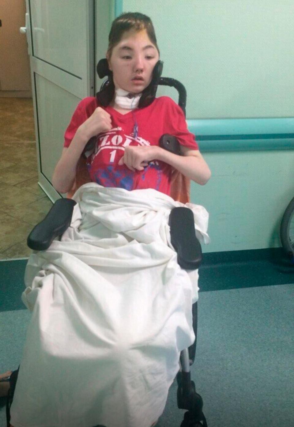 Chống trả tên hàng xóm cưỡng hiếp mẹ, cậu học sinh bị đánh mất nửa hộp sọ, mẹ đau đớn không dám đến thăm con-3