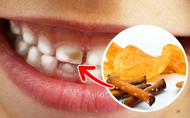 90% người Việt mắc bệnh răng miệng chỉ vì 10 thói quen khó bỏ này-9