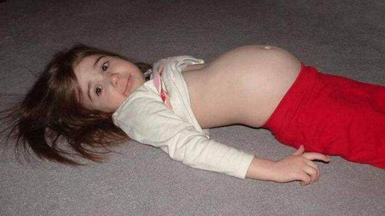 Bé gái 9 tuổi kêu đau bụng, bác sĩ nói: Có một đứa trẻ ở trong-1