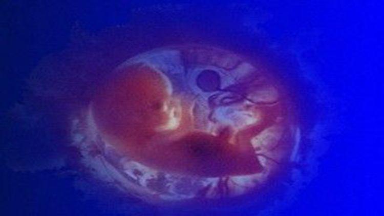 Bé gái 9 tuổi kêu đau bụng, bác sĩ nói: Có một đứa trẻ ở trong-2