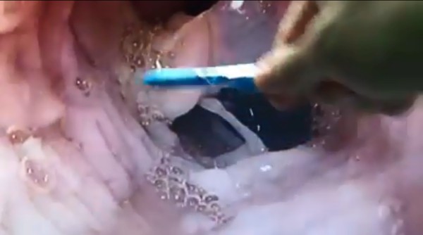 Thức uống này là nguyên nhân khiến người phụ nữ bị tổn thương thực quản, rất nhiều dân văn phòng cũng hay uống-1