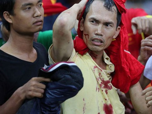 Họp báo Malaysia - Việt Nam: Đội chủ nhà nguy cơ vắng 3 trụ cột-5