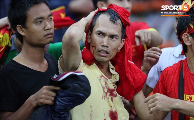 Đêm kinh hoàng: CĐV Malaysia đánh CĐV Việt Nam đổ máu ở AFF Cup 2014-6