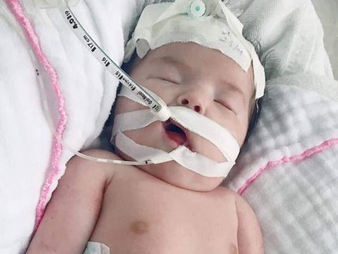 Mẹ Việt khóc cạn nước mắt khi nằm trên bàn mổ, bác sĩ thông báo con bị gãy 2 tay dù siêu âm bình thường