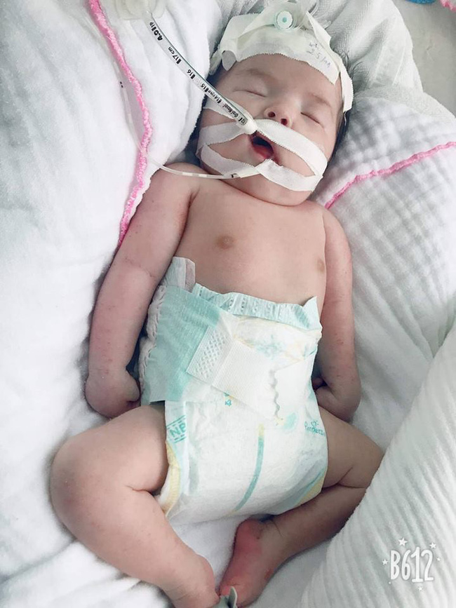 Mẹ Việt khóc cạn nước mắt khi nằm trên bàn mổ, bác sĩ thông báo con bị gãy 2 tay dù siêu âm bình thường-3