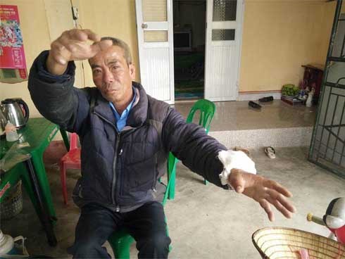 Người lao vào lửa cứu nạn nhân vụ con gái ôm mẹ tự thiêu kể lại phút giây sinh tử