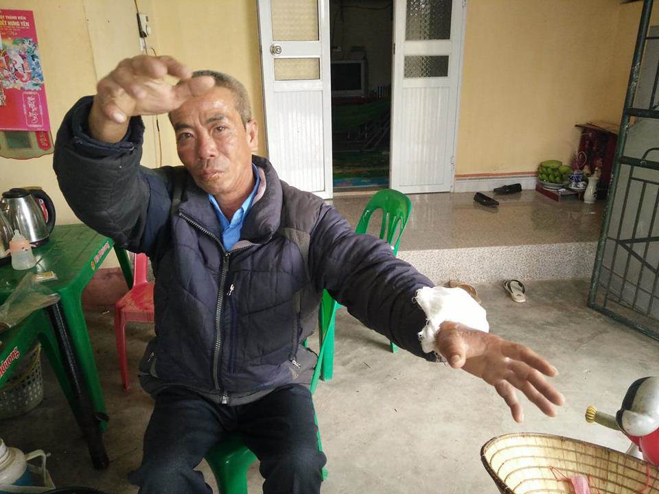 Người lao vào lửa cứu nạn nhân vụ con gái ôm mẹ tự thiêu kể lại phút giây sinh tử-1