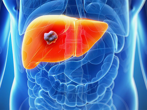 Người phụ nữ mắc ung thư do nhuộm tóc, con gái đau lòng để mẹ chết tự nguyện-3