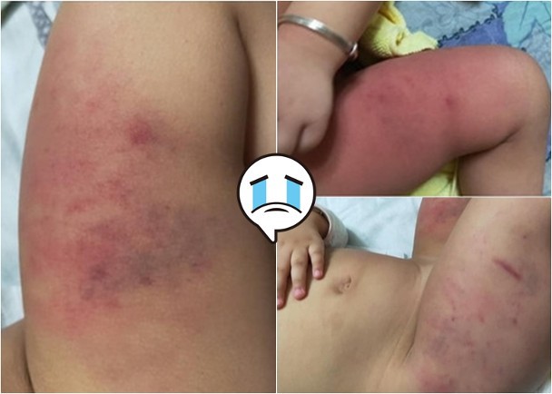 Dân mạng sục sôi truy tìm danh tính bé gái 1 tuổi nghi bị bố bạo hành đến bầm tím cơ thể-2