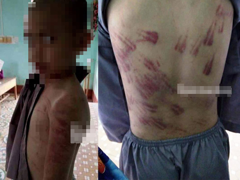 Trần tình của sư thầy bạo hành bé trai 10 tuổi thâm tím khắp người-6