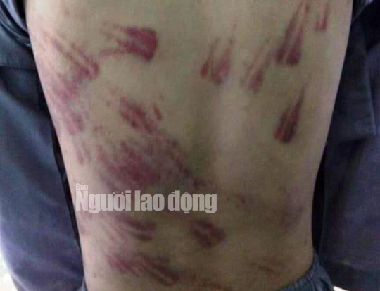Trần tình của sư thầy bạo hành bé trai 10 tuổi thâm tím khắp người-1